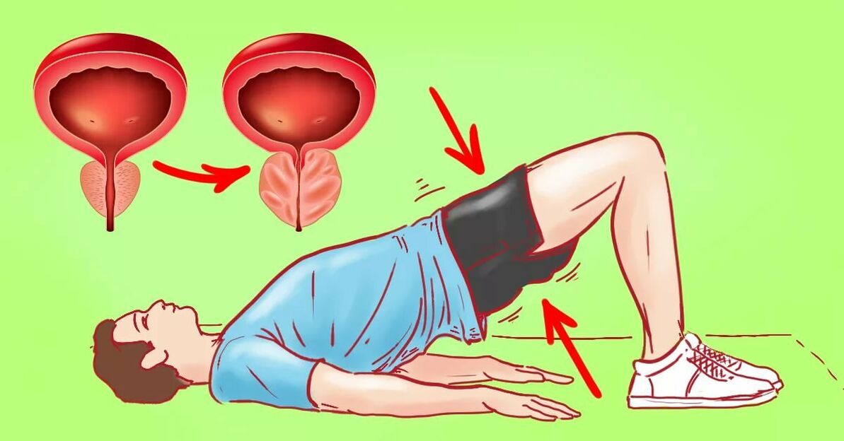 Exerciții pentru prostatită